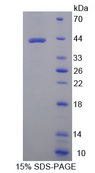 GOT2 Protein - Recombinant Aspartate Aminotransferase 2 By SDS-PAGE