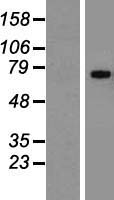 GP1BA / CD42b Protein - Western validation with an anti-DDK antibody * L: Control HEK293 lysate R: Over-expression lysate