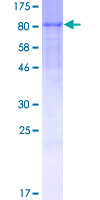 GP1BA / CD42b Protein - 12.5% SDS-PAGE of human GP1BA stained with Coomassie Blue