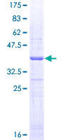 GP1BA / CD42b Protein - 12.5% SDS-PAGE Stained with Coomassie Blue.