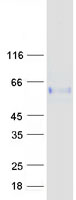 GP2 Protein - Purified recombinant protein GP2 was analyzed by SDS-PAGE gel and Coomassie Blue Staining