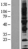 GP6 / GPVI Protein - Western validation with an anti-DDK antibody * L: Control HEK293 lysate R: Over-expression lysate