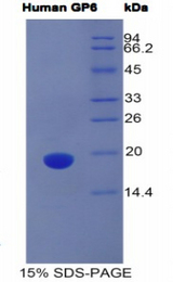 GP6 / GPVI Protein - Recombinant Glycoprotein VI, Platelet By SDS-PAGE