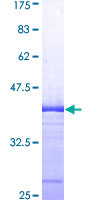 GP78 / AMFR Protein - 12.5% SDS-PAGE Stained with Coomassie Blue.