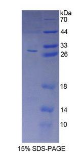 GP78 / AMFR Protein - Recombinant  Autocrine Motility Factor Receptor By SDS-PAGE