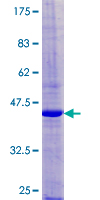 GP9 / CD42a Protein - 12.5% SDS-PAGE of human GP9 stained with Coomassie Blue