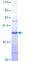 GP9 / CD42a Protein - 12.5% SDS-PAGE Stained with Coomassie Blue.