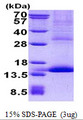 GP9 / CD42a Protein