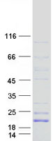 GP9 / CD42a Protein - Purified recombinant protein GP9 was analyzed by SDS-PAGE gel and Coomassie Blue Staining
