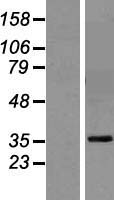 GPA33 / A33 Protein - Western validation with an anti-DDK antibody * L: Control HEK293 lysate R: Over-expression lysate