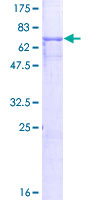 GPA33 / A33 Protein - 12.5% SDS-PAGE of human GPA33 stained with Coomassie Blue