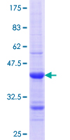 GPA33 / A33 Protein - 12.5% SDS-PAGE Stained with Coomassie Blue.