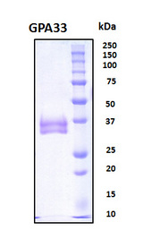 GPA33 / A33 Protein - SDS-PAGE under reducing conditions and visualized by Coomassie blue staining