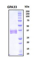 GPA33 / A33 Protein - SDS-PAGE under reducing conditions and visualized by Coomassie blue staining