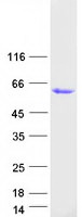 GPA33 / A33 Protein - Purified recombinant protein GPA33 was analyzed by SDS-PAGE gel and Coomassie Blue Staining