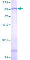 GPAA1 Protein - 12.5% SDS-PAGE of human GPAA1 stained with Coomassie Blue