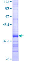 GPAA1 Protein - 12.5% SDS-PAGE Stained with Coomassie Blue.
