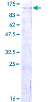 GPAM Protein - 12.5% SDS-PAGE of human GPAM stained with Coomassie Blue