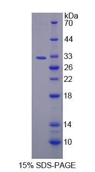 GPAM Protein - Recombinant  Glycerol-3-Phosphate Acyltransferase, Mitochondrial By SDS-PAGE