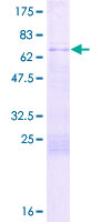GPANK1 / G5 Protein - 12.5% SDS-PAGE of human BAT4 stained with Coomassie Blue