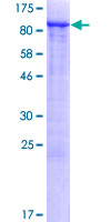 GPATC3 Protein - 12.5% SDS-PAGE of human GPATCH3 stained with Coomassie Blue