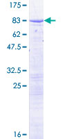 GPATCH2 Protein - 12.5% SDS-PAGE of human GPATCH2 stained with Coomassie Blue
