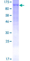 GPBB / PYGB Protein - 12.5% SDS-PAGE of human PYGB stained with Coomassie Blue
