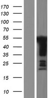 GPBP1 Protein - Western validation with an anti-DDK antibody * L: Control HEK293 lysate R: Over-expression lysate