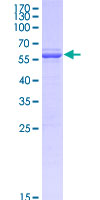 GPBP1 Protein - 12.5% SDS-PAGE of human GPBP1 stained with Coomassie Blue