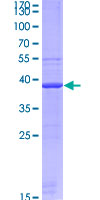 GPC1 / Glypican Protein - 12.5% SDS-PAGE Stained with Coomassie Blue.