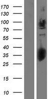 GPC2 / Glypican 2 Protein - Western validation with an anti-DDK antibody * L: Control HEK293 lysate R: Over-expression lysate
