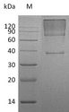 GPC3 / Glypican 3 Protein - (Tris-Glycine gel) Discontinuous SDS-PAGE (reduced) with 5% enrichment gel and 15% separation gel.