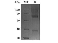 GPC3 / Glypican 3 Protein - Recombinant Human Glypican-3/GPC3/OCI5 (C-6His-Avi) Biotinylated