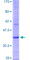 GPC3 / Glypican 3 Protein - 12.5% SDS-PAGE Stained with Coomassie Blue.