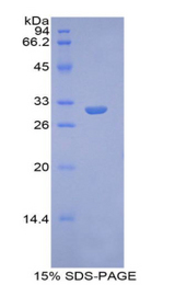 GPC4 / Glypican 4 Protein - Recombinant Glypican 4 By SDS-PAGE