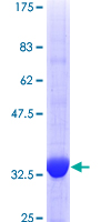 GPC5 / Glypican 5 Protein - 12.5% SDS-PAGE Stained with Coomassie Blue.