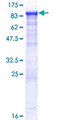 GPCPD1 Protein - 12.5% SDS-PAGE of human RP5-1022P6.2 stained with Coomassie Blue