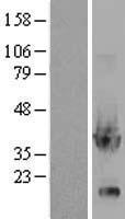 GPD1 Protein - Western validation with an anti-DDK antibody * L: Control HEK293 lysate R: Over-expression lysate