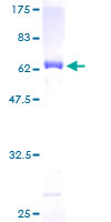 GPD1 Protein - 12.5% SDS-PAGE of human GPD1 stained with Coomassie Blue