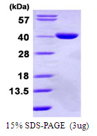 GPD1L Protein