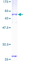 GPD2 Protein - 12.5% SDS-PAGE of human GPD2 stained with Coomassie Blue