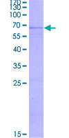 GPER1 / GPR30 Protein - 12.5% SDS-PAGE of human GPR30 stained with Coomassie Blue