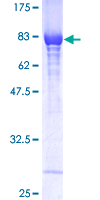 GPI Protein - 12.5% SDS-PAGE of human GPI stained with Coomassie Blue