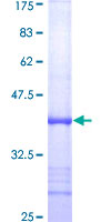 GPI Protein - 12.5% SDS-PAGE Stained with Coomassie Blue.