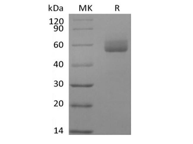 GPIHBP1 Protein - Recombinant Human GPIHBP1 (C-Fc)