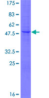 GPIHBP1 Protein - 12.5% SDS-PAGE of human GPIHBP1 stained with Coomassie Blue