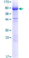 GPKOW Protein - 12.5% SDS-PAGE of human GPKOW stained with Coomassie Blue