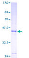 GPLD1 / GPIPLD Protein - 12.5% SDS-PAGE of human GPLD1 stained with Coomassie Blue