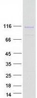 GPLD1 / GPIPLD Protein - Purified recombinant protein GPLD1 was analyzed by SDS-PAGE gel and Coomassie Blue Staining
