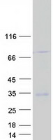 GPM6A / Glycoprotein M6A Protein - Purified recombinant protein GPM6A was analyzed by SDS-PAGE gel and Coomassie Blue Staining